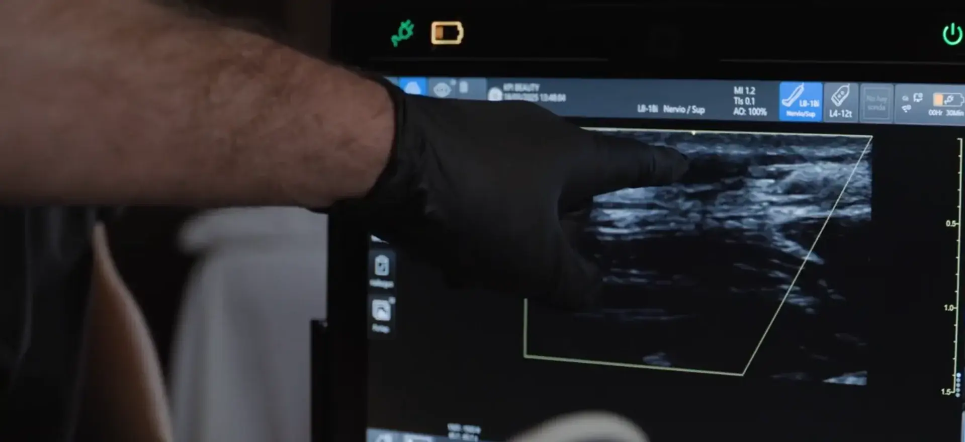 Imagen de ultrasonido señalada en el equipo